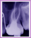 Logo of Pinole Endodontics