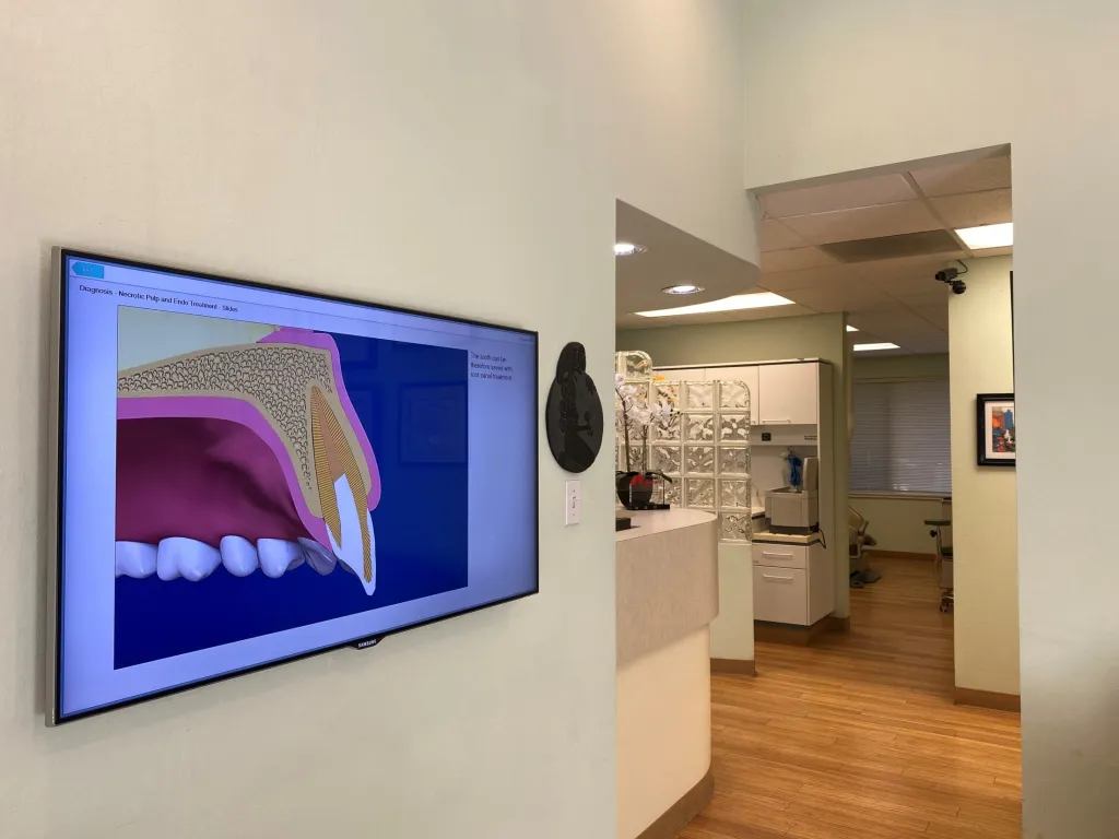 A TV showing a tooth in the office hallway