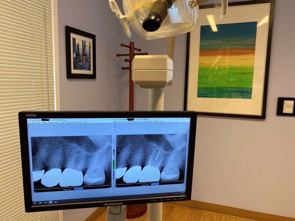 A TV showing teeth X-Ray