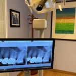 A TV showing teeth X-Ray